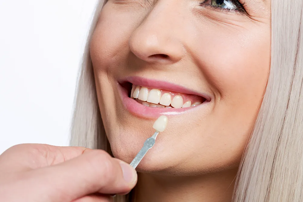 Metal-free dental crowns
